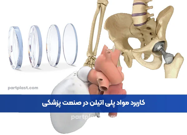تفاوت بین تزریق پلاستیک و اکستروژن پلاستیک چیست؟